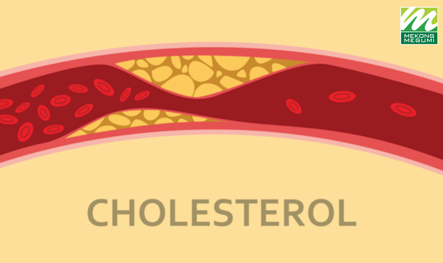Cholesterol: bạn đ&atilde; biết số của m&igrave;nh chưa?