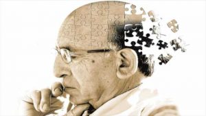 Những điều bạn cần biết về bệnh Alzheimer